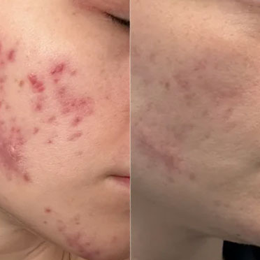 Before and after