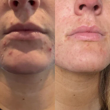 Before and after