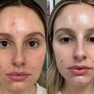 Before and after